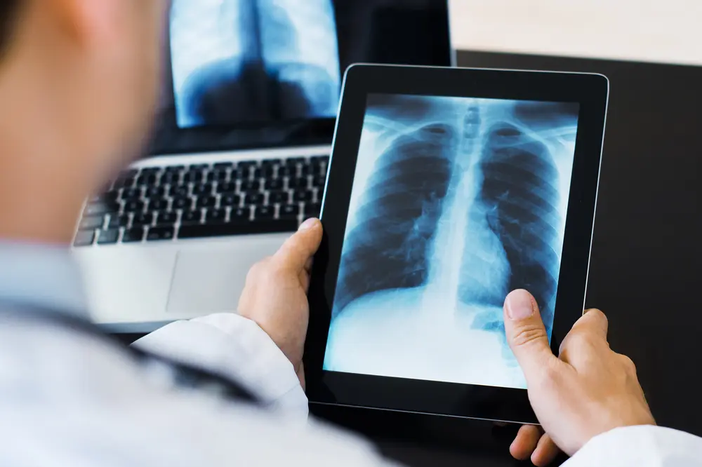 Radiographer reviewing an x-ray